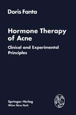 Hormone Therapy of Acne: Clinical and Experimental Principles