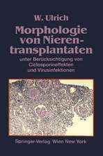 Morphologie von Nierentransplantaten: unter Berücksichtigung von Ciclosporineffekten und Virusinfektionen