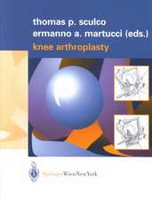 Knee Arthroplasty