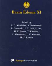 Brain Edema XI: Proceedings of the 11th International Symposium, Newcastle-upon-Tyne, United Kingdom, June 6–10, 1999