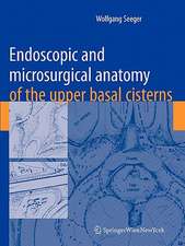 Endoscopic and microsurgical anatomy of the upper basal cisterns