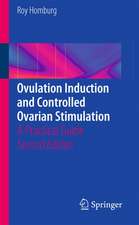 Ovulation Induction and Controlled Ovarian Stimulation: A Practical Guide