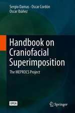 Handbook on Craniofacial Superimposition: The MEPROCS Project