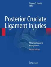 Posterior Cruciate Ligament Injuries: A Practical Guide to Management