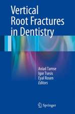 Vertical Root Fractures in Dentistry