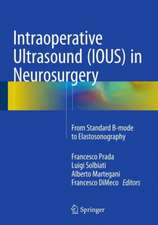 Intraoperative Ultrasound (IOUS) in Neurosurgery: From Standard B-mode to Elastosonography