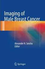 Imaging of Male Breast Cancer