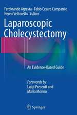 Laparoscopic Cholecystectomy: An Evidence-Based Guide