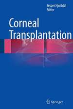 Corneal Transplantation