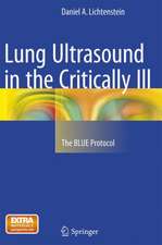 Lung Ultrasound in the Critically Ill: The BLUE Protocol