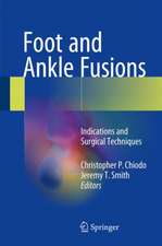 Foot and Ankle Fusions: Indications and Surgical Techniques