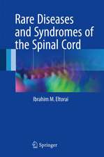 Rare Diseases and Syndromes of the Spinal Cord