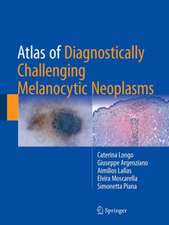 Atlas of Diagnostically Challenging Melanocytic Neoplasms