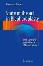 State of the art in Blepharoplasty: From Surgery to the Avoidance of Complications