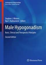 Male Hypogonadism: Basic, Clinical and Therapeutic Principles