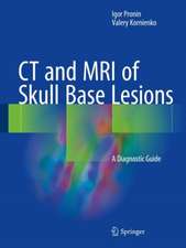 CT and MRI of Skull Base Lesions : A Diagnostic Guide