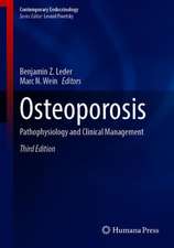 Osteoporosis: Pathophysiology and Clinical Management