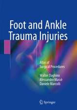 Foot and Ankle Trauma Injuries: Atlas of Surgical Procedures