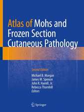 Atlas of Mohs and Frozen Section Cutaneous Pathology