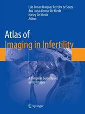 Atlas of Imaging in Infertility: A Complete Guide Based in Key Images