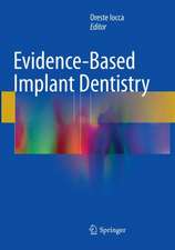 Evidence-Based Implant Dentistry