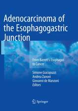 Adenocarcinoma of the Esophagogastric Junction: From Barrett's Esophagus to Cancer