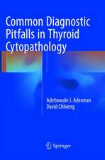 Common Diagnostic Pitfalls in Thyroid Cytopathology