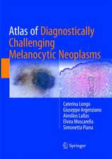 Atlas of Diagnostically Challenging Melanocytic Neoplasms