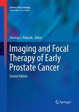 Imaging and Focal Therapy of Early Prostate Cancer