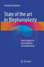 State of the art in Blepharoplasty: From Surgery to the Avoidance of Complications