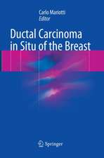 Ductal Carcinoma in Situ of the Breast