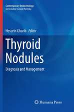 Thyroid Nodules: Diagnosis and Management