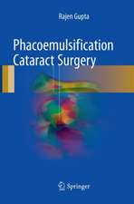 Phacoemulsification Cataract Surgery