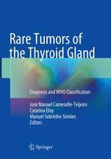 Rare Tumors of the Thyroid Gland: Diagnosis and WHO classification