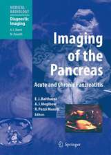 Imaging of the Pancreas