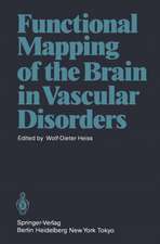 Functional Mapping of the Brain in Vascular Disorders