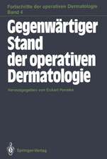 Gegenwärtiger Stand der operativen Dermatologie