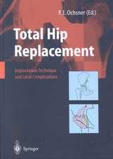 Total Hip Replacement: Implantation Technique and Local Complications