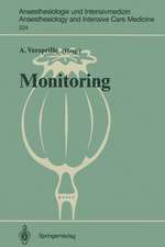 Monitoring