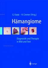 Hamangiome