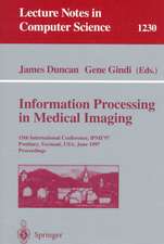 Information Processing in Medical Imaging: 15th International Conference, IPMI'97, Poultney, Vermont, USA, June 9-13, 1997, Proceedings