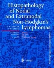 Histopathology of Nodal and Extranodal Non-Hodgkin’s Lymphomas