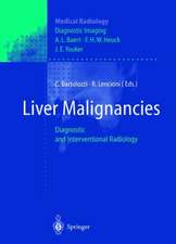 Liver Malignancies