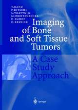 Imaging of Bone and Soft Tissue Tumors: A Case Study Approach