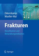 Frakturen: Klassifikation und Behandlungsoptionen