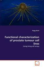 Functional Characterization of Prostate Tumour Cell Lines