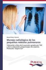 Manejo Radiologico de Los Pequenos Nodulos Pulmonares: Estudio Prospectivo En Espana