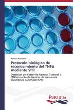 Protocolo Biologico de Reconocimiento del Tnf Mediante Spr