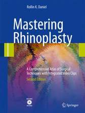 Mastering Rhinoplasty: A Comprehensive Atlas of Surgical Techniques with Integrated Video Clips