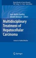 Multidisciplinary Treatment of Hepatocellular Carcinoma